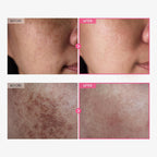 TOSOWOONG Arbutin 7% + Tranexamic Acid 4% Brightening Cream – Dark Spot & Pigmentation Care (50ml)