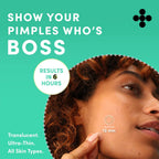 Dots for Spots Acne Patches – 60 Hydrocolloid Pimple Stickers, Fast-Acting & Vegan