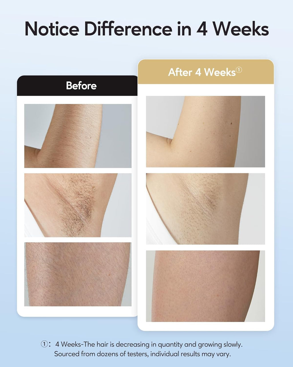 INNZA IPL Hair Removal Device – Painless 9-Level Laser with Ice Cooling for Face, Body & Bikini