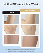 INNZA IPL Hair Removal Device – Painless 9-Level Laser with Ice Cooling for Face, Body & Bikini