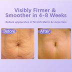 Tighten & Smooth Belly Cream – Firming Body Lotion for Stretch Marks & Sagging