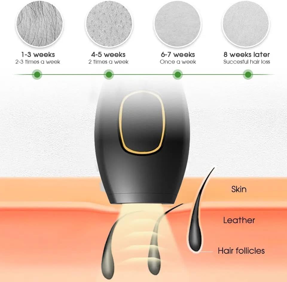 IPL Hair Removal Device – Painless Laser for Face, Body & Bikini (5 Levels, 999,999 Flashes)