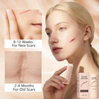 Silicone Scar Gel Stick – Lightweight Treatment for Old & New Scars