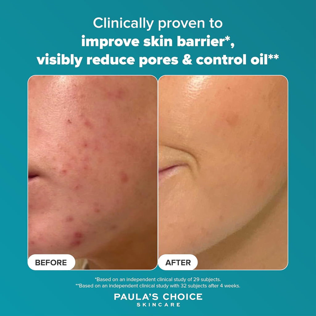 Paula’s Choice 2% BHA Liquid Exfoliant – Salicylic Acid for Blackheads & Pores (118ml)