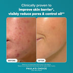 Paula’s Choice 2% BHA Liquid Exfoliant – Salicylic Acid for Blackheads & Pores (118ml)