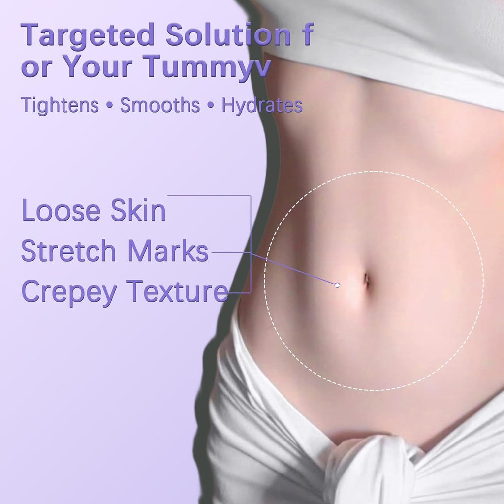 Tighten & Smooth Belly Cream – Firming Body Lotion for Stretch Marks & Sagging