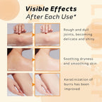 Turmeric & Kojic Acid Peel Spray 200ml – Smooth, Bright & Hydrated Skin