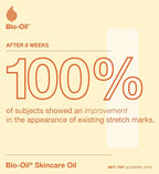Bio‑Oil Skincare Oil 200ml – Stretch Marks & Scars