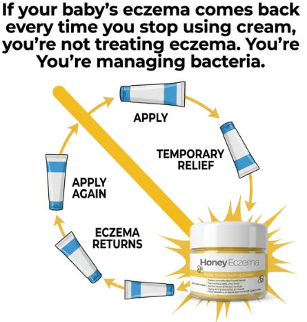 Honey Eczema - Baby Eczema cream