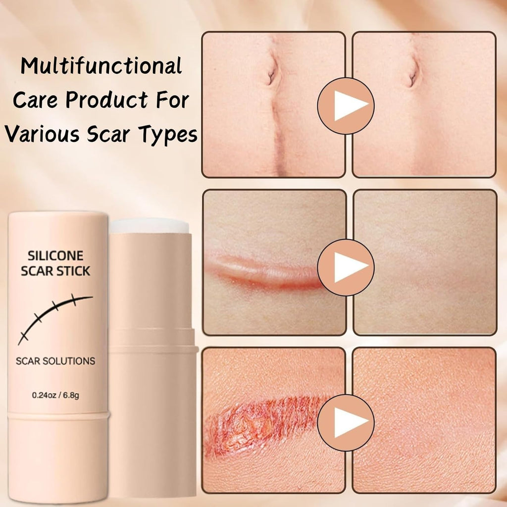 Silicone Scar Gel Stick – Lightweight Treatment for Old & New Scars