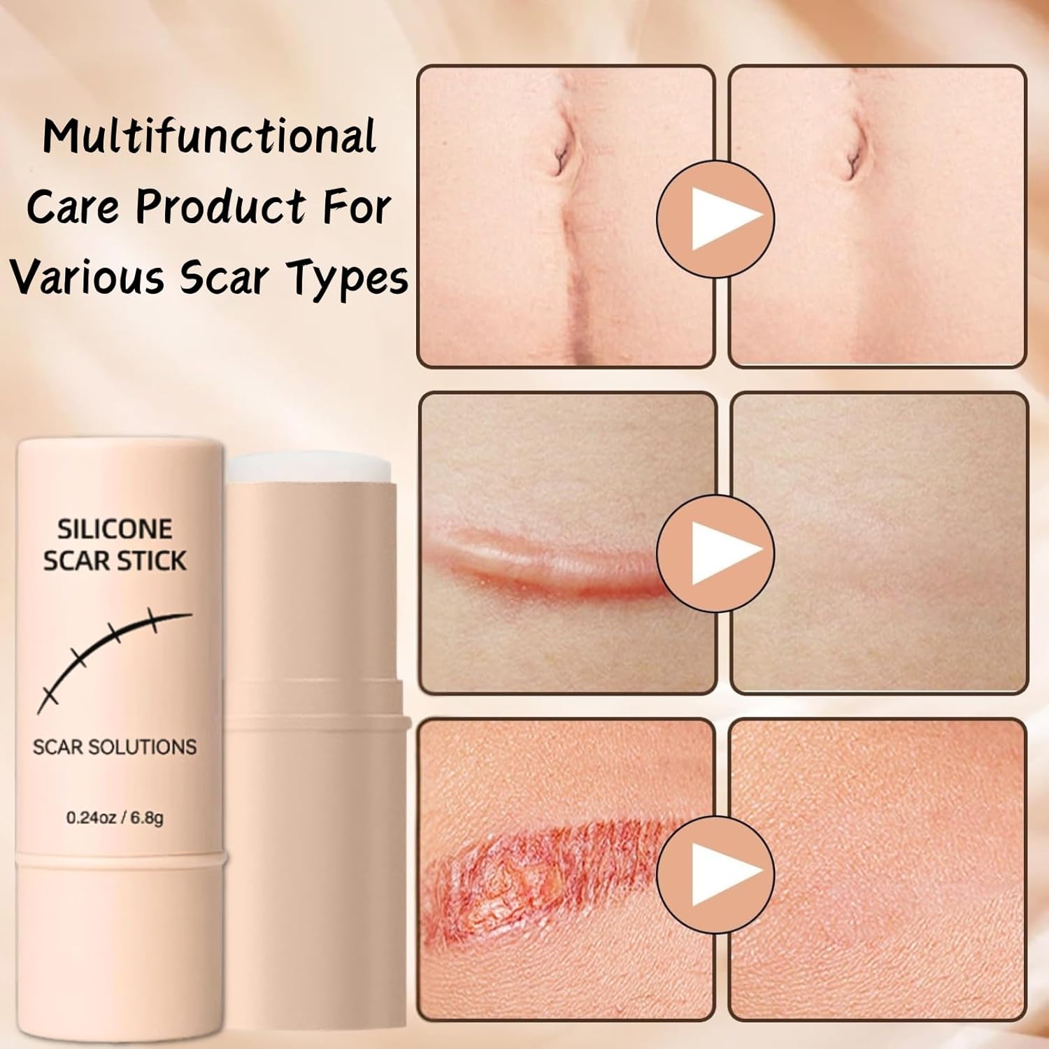 Silicone Scar Gel Stick – Lightweight Treatment for Old & New Scars