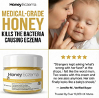 Honey Eczema - Baby Eczema cream