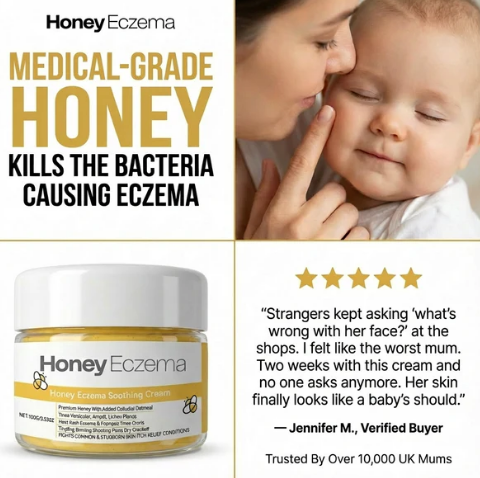 Honey Eczema - Baby Eczema cream