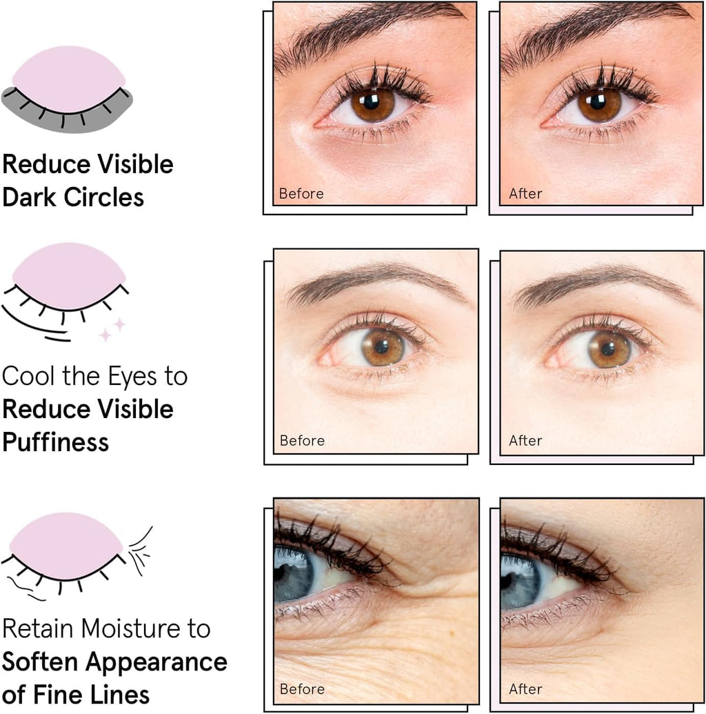 Grace & Stella Gold Under Eye Mask – Dark Circle, Puffiness & Wrinkle Reducer (24 Pairs, Vegan)