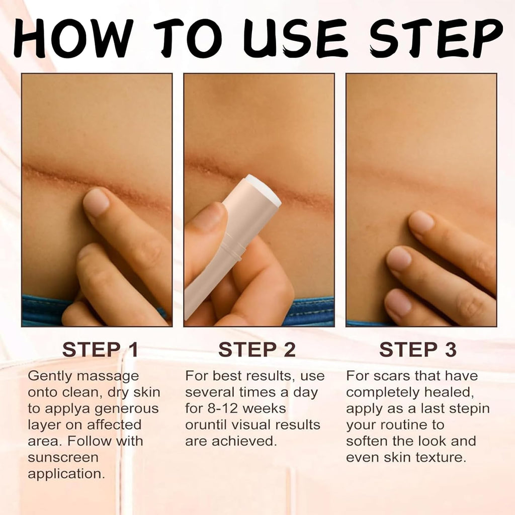 Silicone Scar Gel Stick – Lightweight Treatment for Old & New Scars