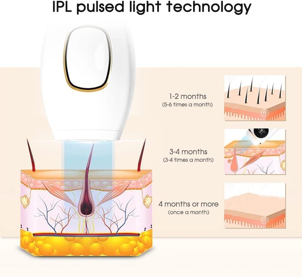 IPL Hair Removal Device – Painless Laser for Face, Body & Bikini (5 Levels, 999,999 Flashes)